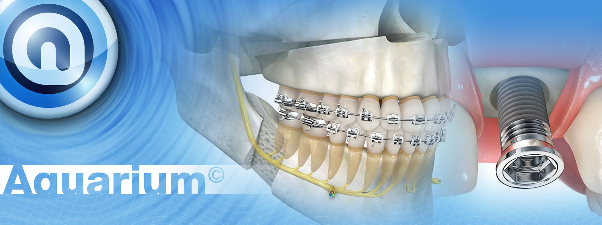 OMS Gallery Aquarium Orthodontic Imaging and Practice Management