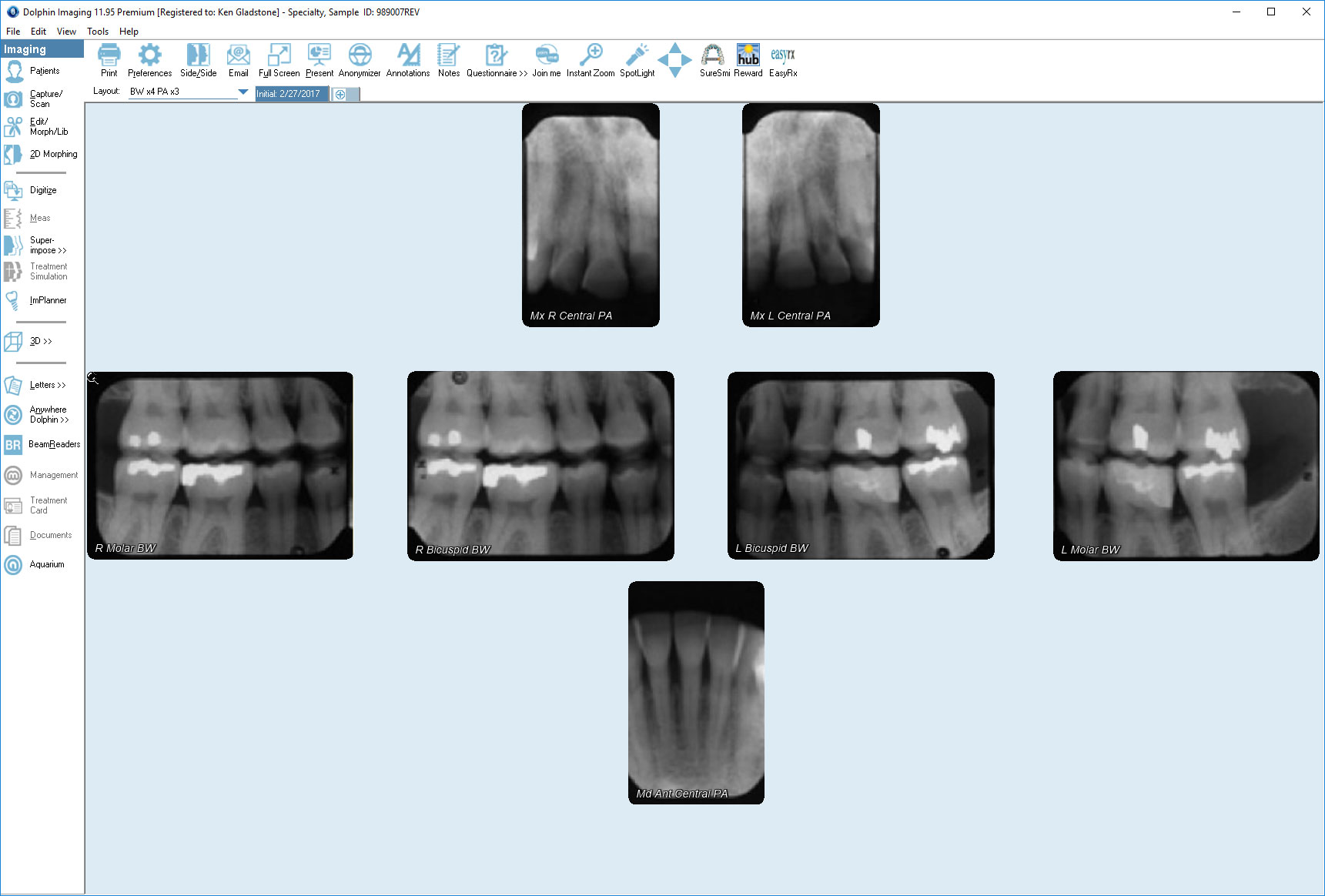 Fmx X Ray Template No Tax www deborahsilvermusic com Fmx X Ray Template No Tax www deborahsilvermusic com