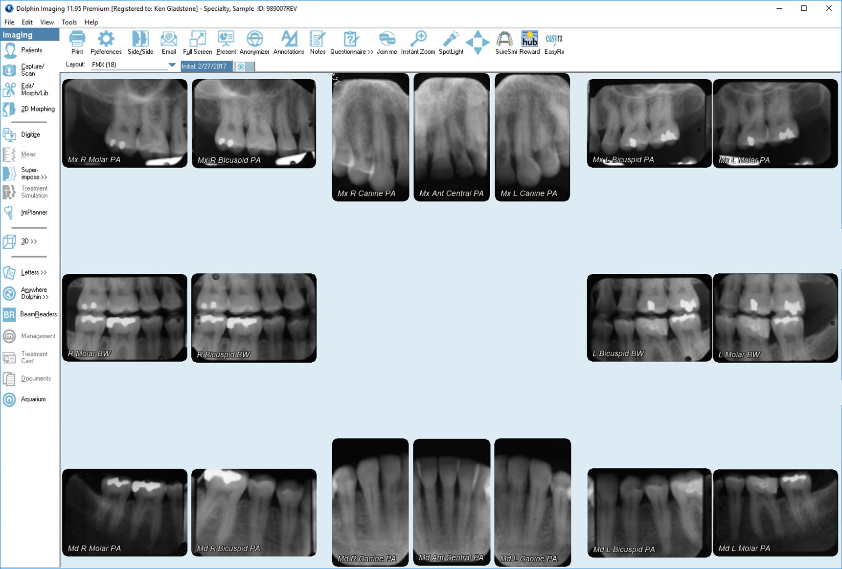 ☢️ FMX Dental X-ray Guide (Are They Safe?)