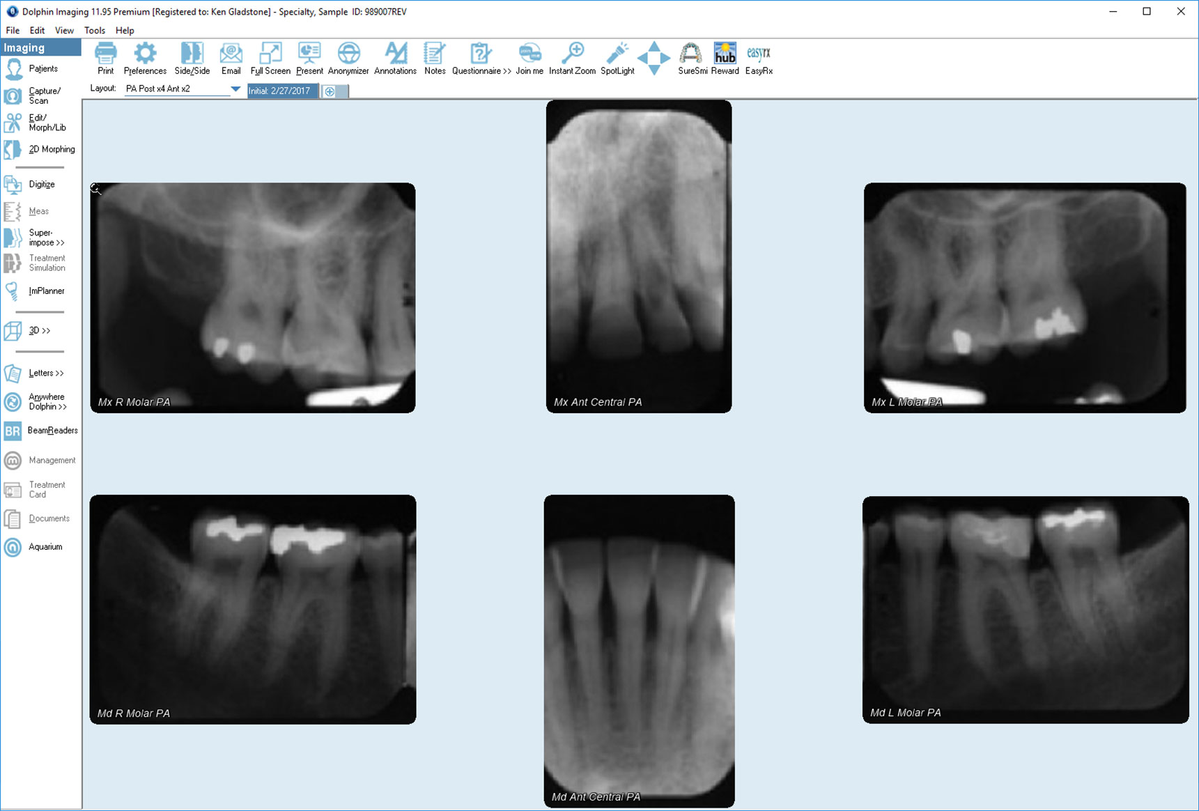 ☢️ FMX Dental X-ray Guide (Are They Safe?)