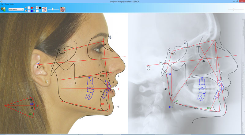 dolphin imaging software dolphin imaging software