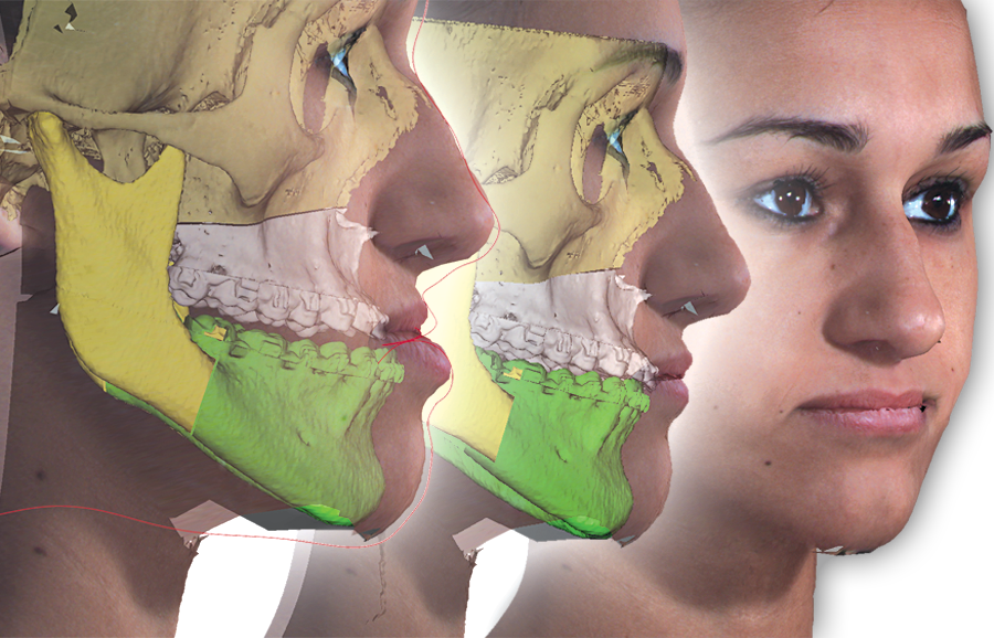 3D Surgery | 3D | Imaging and 3D Imaging | Orthodontic Imaging and Practice Management Software | 1(818)435-1368 | Dolphin Imaging and Management Solutions | Product 3D Surgery | 3D | Imaging and 3D Imaging | Orthodontic Imaging and Practice Management Software | 1(818)435-1368 | Dolphin Imaging and Management Solutions | Product