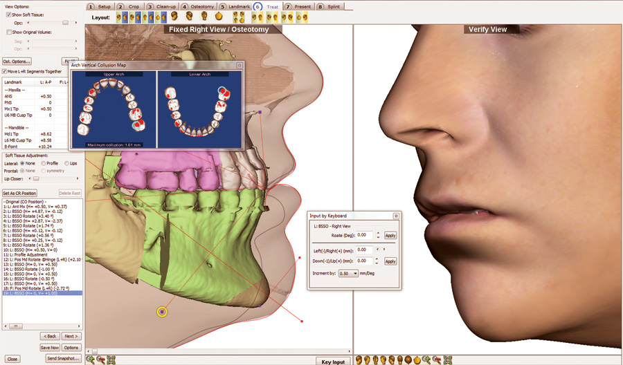 3d Surgery 3d Imaging And 3d Imaging Orthodontic Imaging And Practice Management Software 1 818 435 1368 Dolphin Imaging And Management Solutions Product