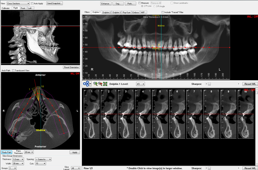 dolphin imaging software downloads dolphin imaging software downloads